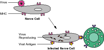 Virus Attacking Nerve Cell